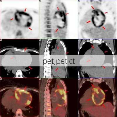 pet,pet ct